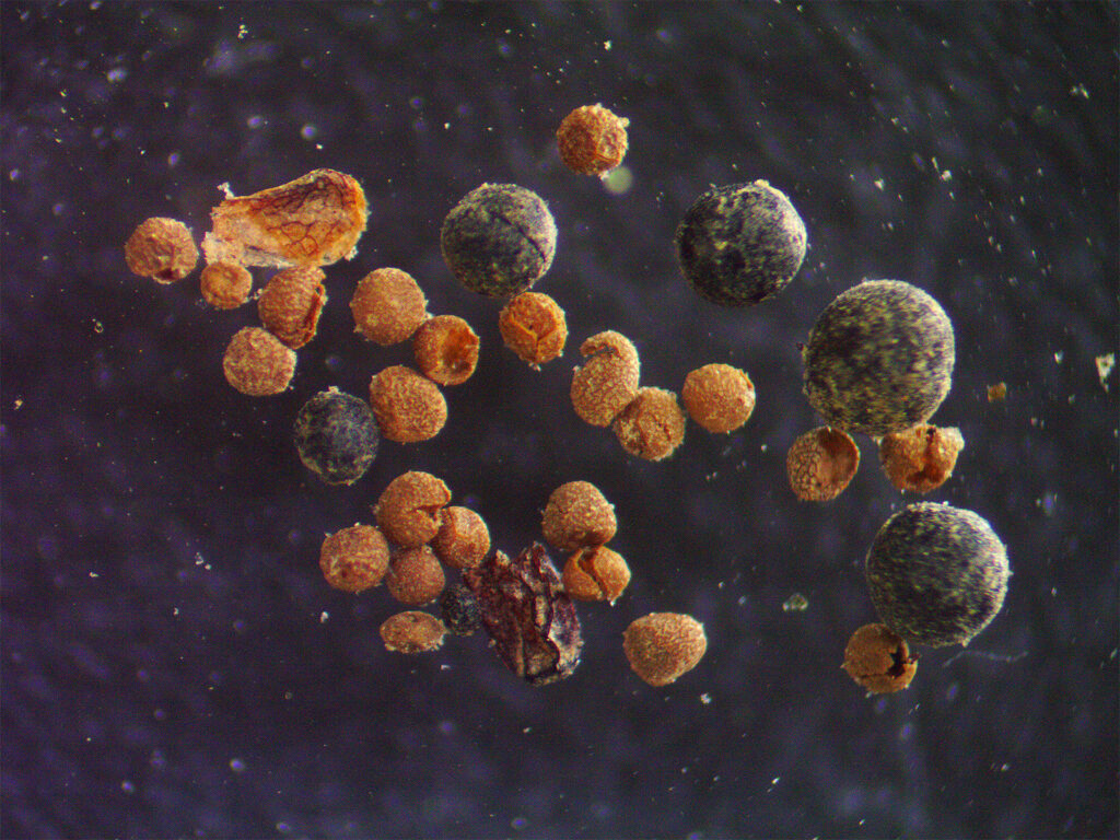 microscopic view of spherical particles of various shades of gray and orange